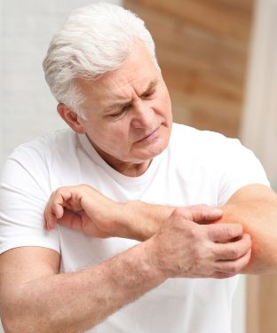Mild Allergic Reactions Treatment Near Me at Niles Street, Brimhall Road, and Ming Avenue in Bakersfield, CA