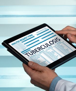 TB Tests Near Me at Niles Street, Brimhall Road, and Ming Avenue in Bakersfield, CA
